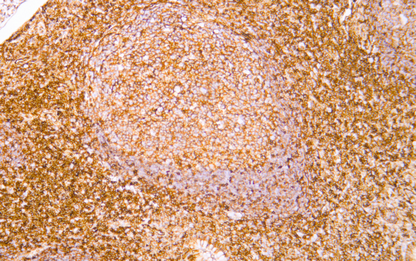 CD99 (ABT156) Mouse mAb