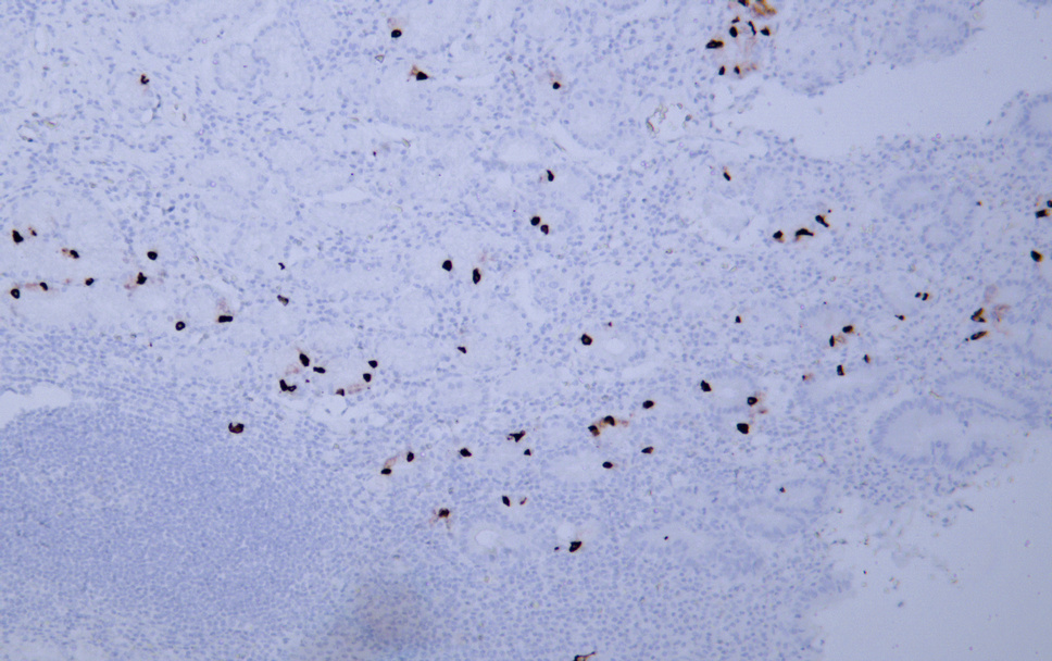 Gastrin (ABT329) Mouse mAb